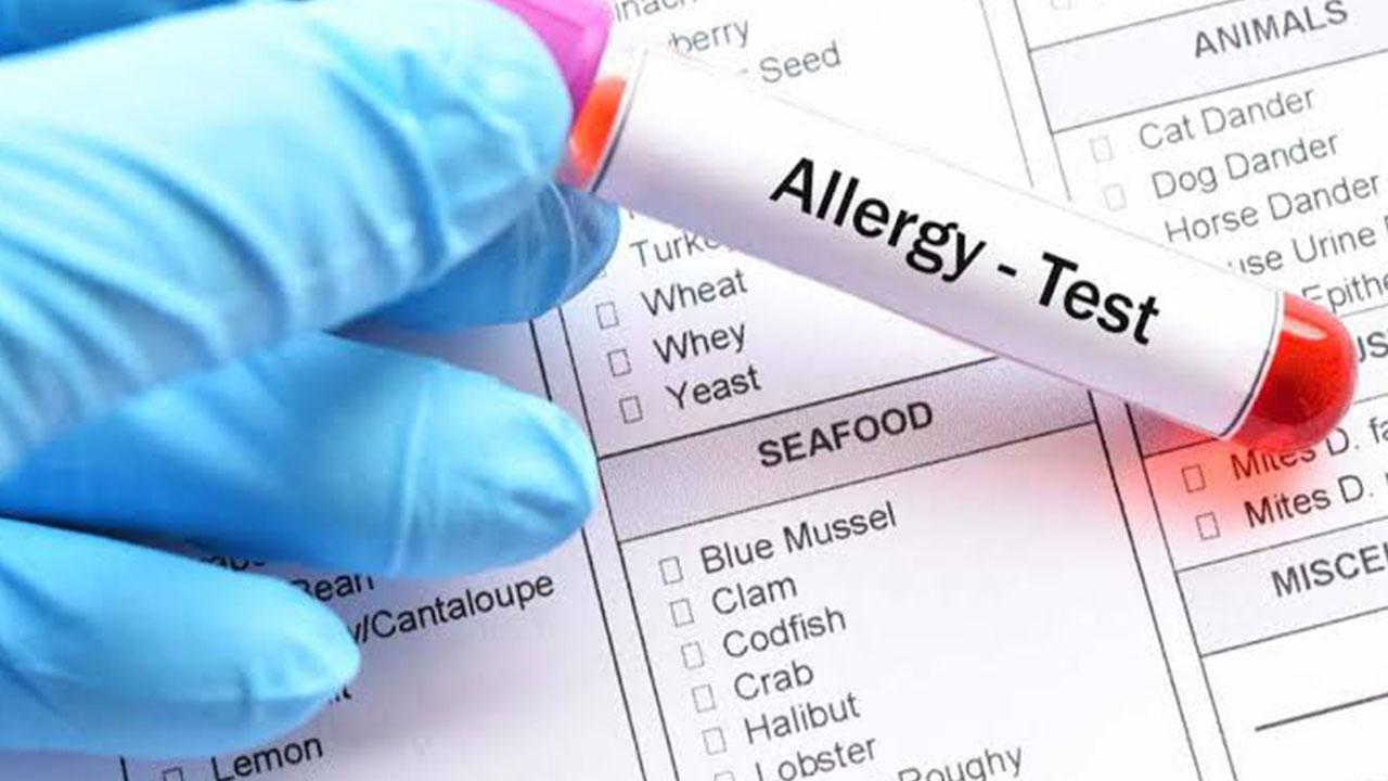 Allergy Tests at Apple Scans & Diagnostics