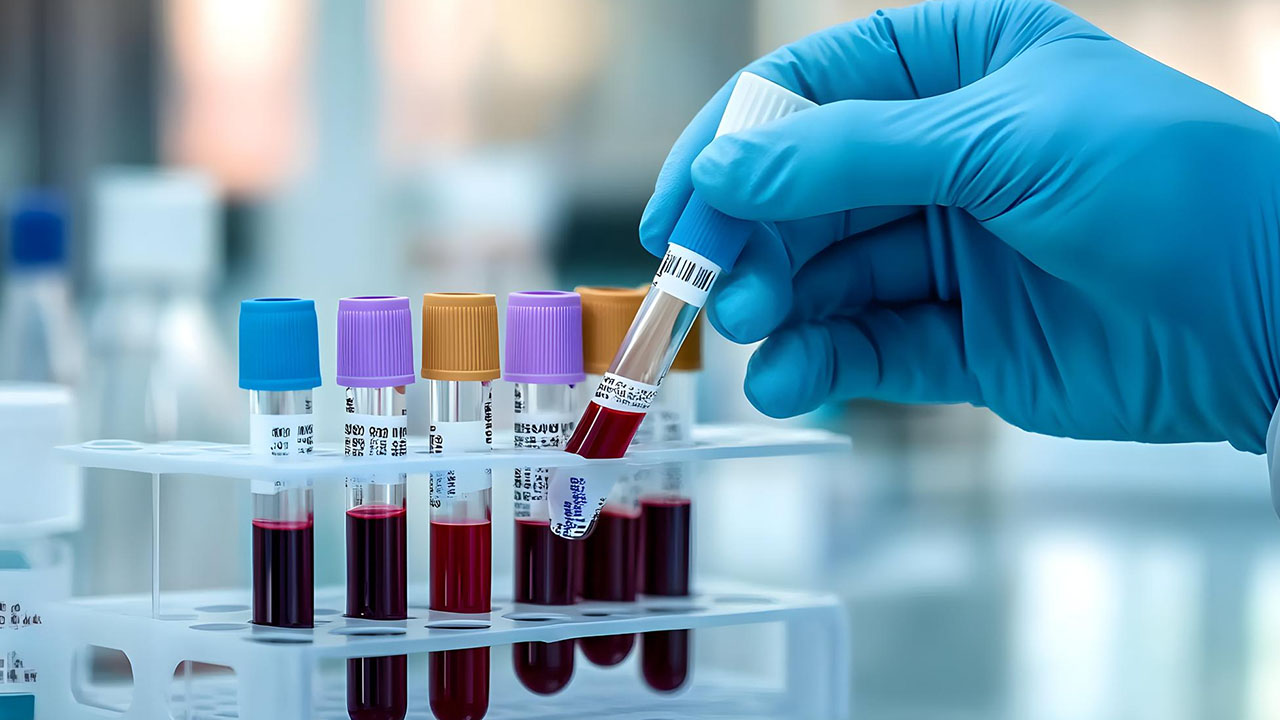 Complete Blood Tests at Apple Scans & Diagnostics