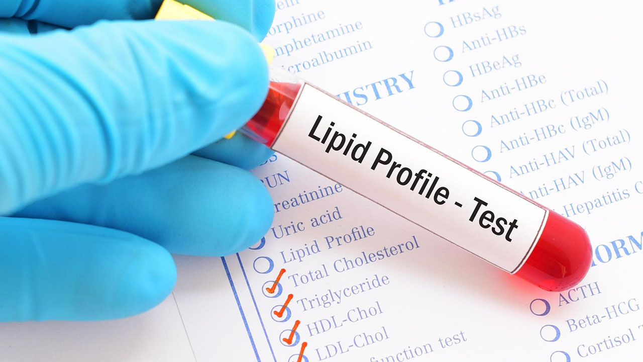 Lipid Profile at Apple Scans & Diagnostics