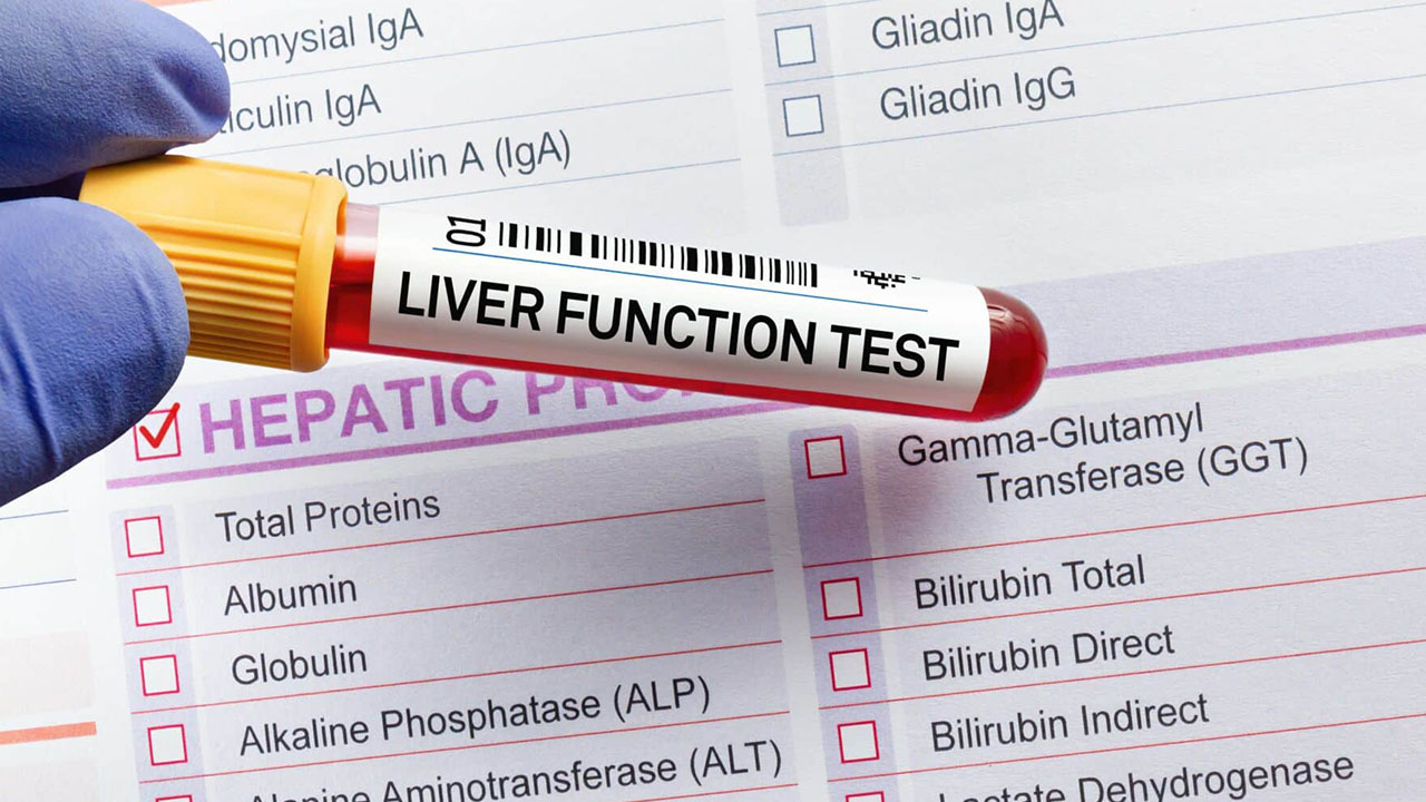 Liver Function Tests