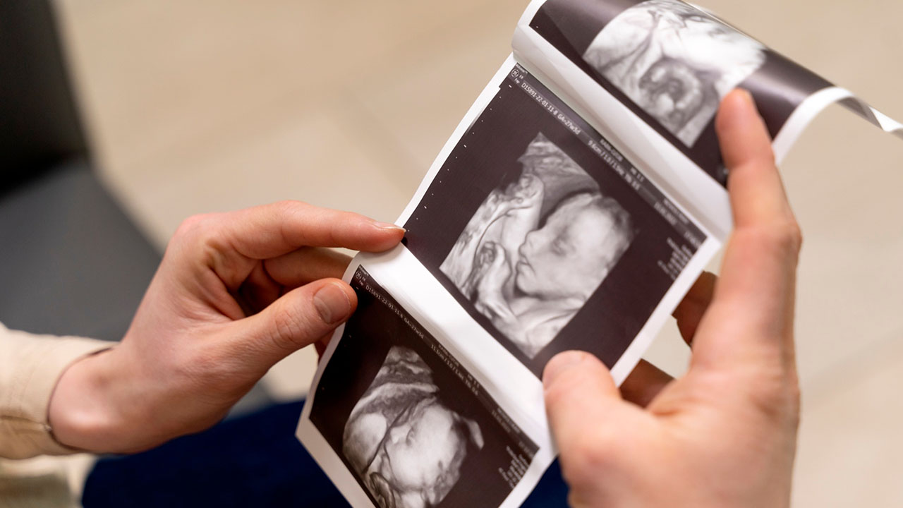 Pregnancy Scans at Apple Scans & Diagnostics