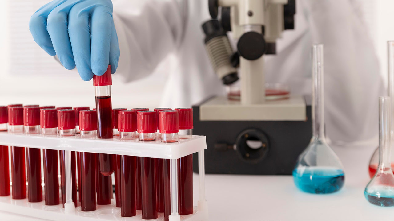 Specialized Blood Tests