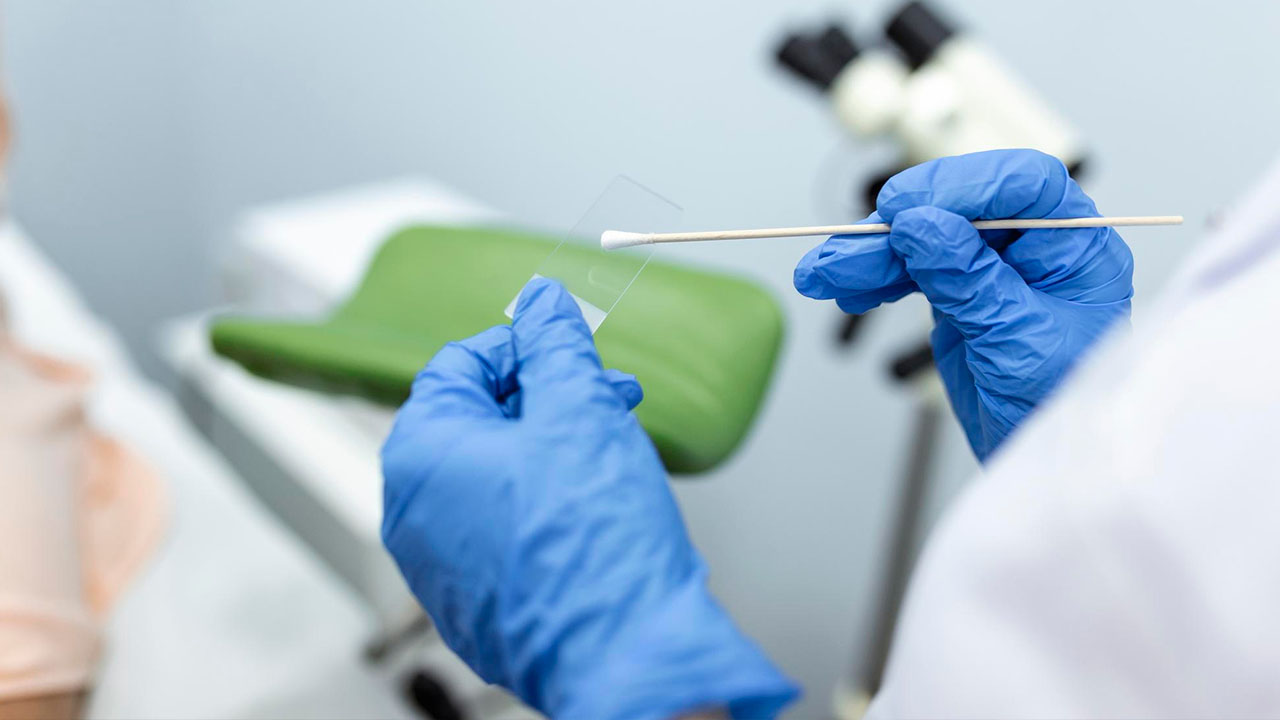 USG Guided Biopsy