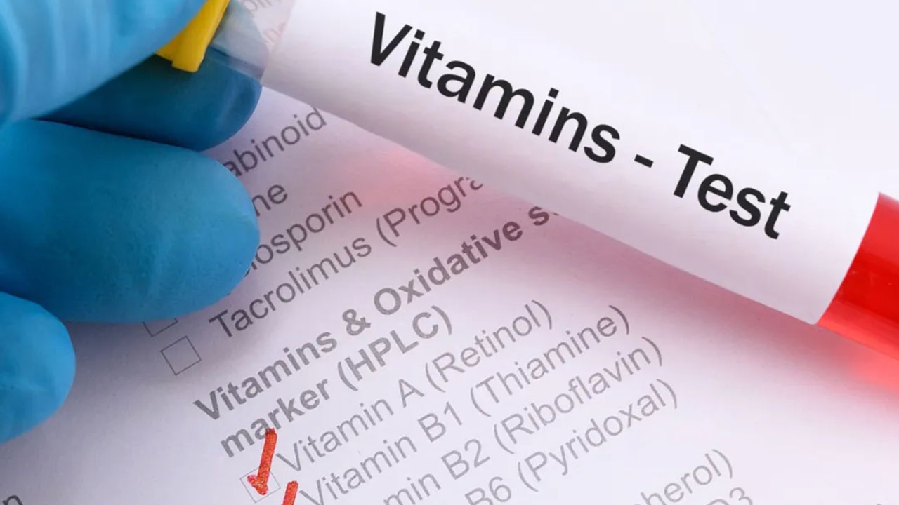 Vitamin Tests at Apple Scans & Diagnostics